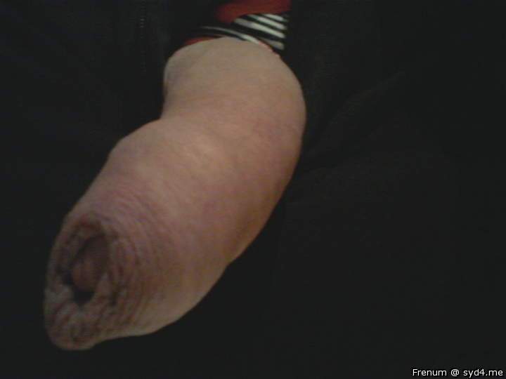 Photo of a middle leg from Frenum
