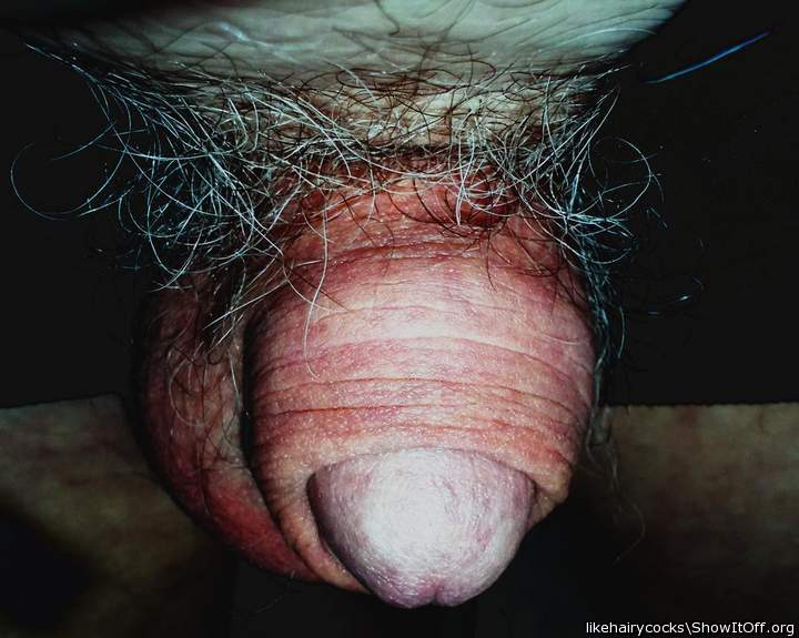 gimme some skin..... foreskin restoration