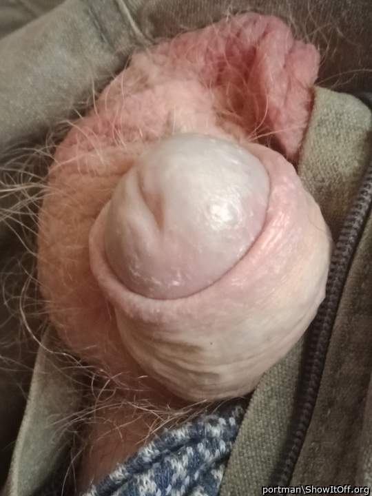 Needs a kiss