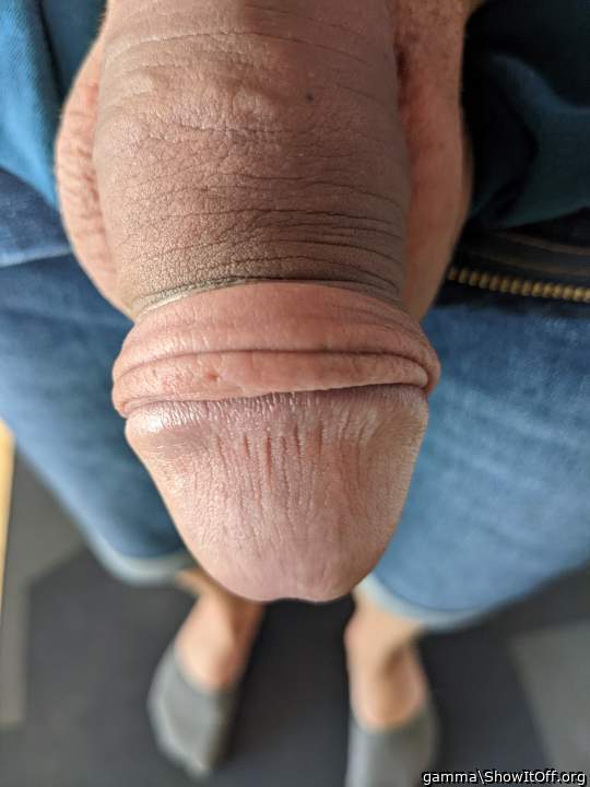 Wow! you have a lot of foreskin