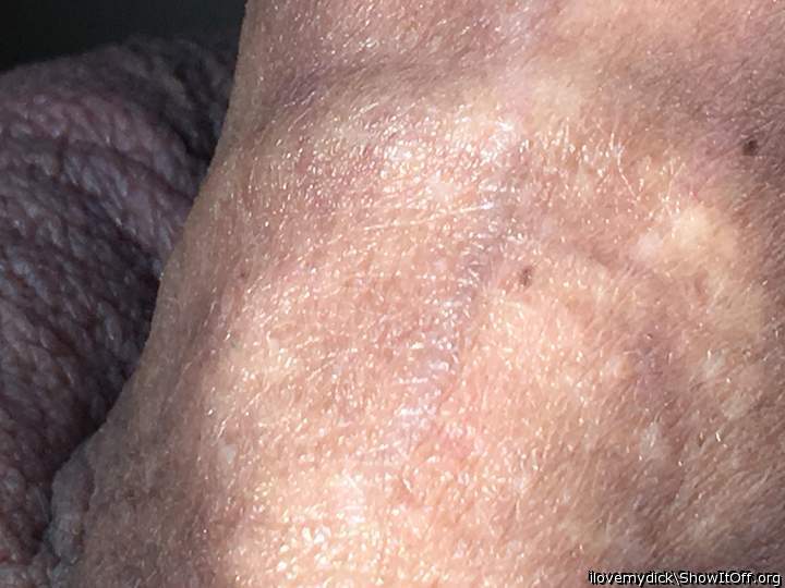 The texture of my penis