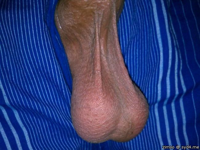 Delicious balls.