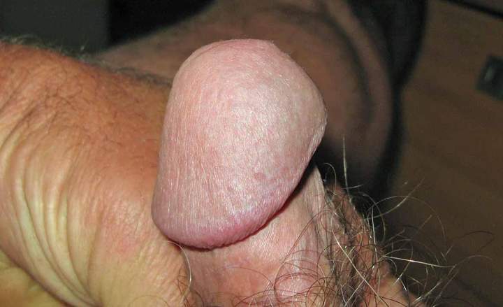 Photo of a boner from turkeyneck