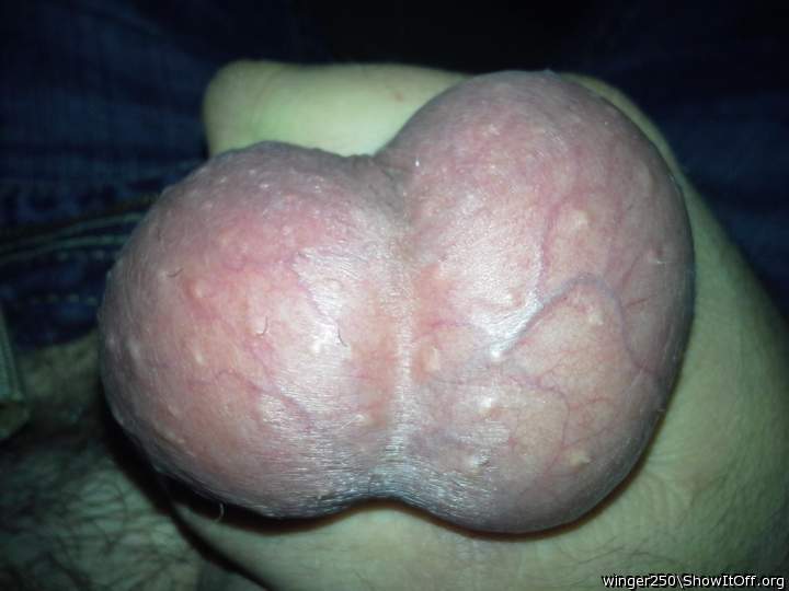 Testicles Photo from winger250