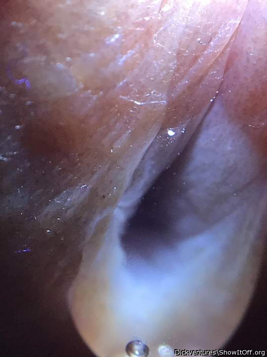 Urethra