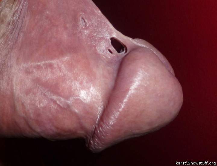 Photo of a prick from karst