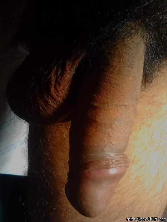 Photo of a horn from mite