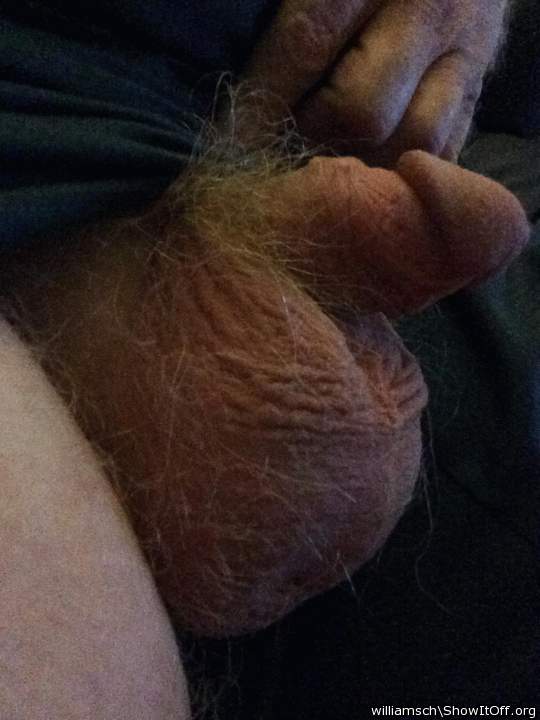 Testicles Photo from williamsch