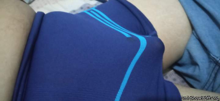 Photo of a penile from imi