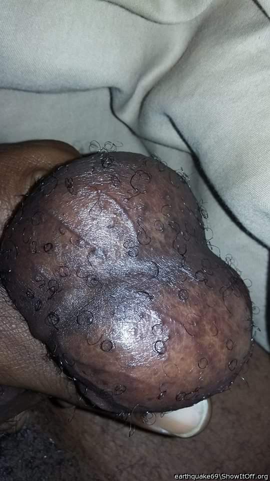 HOT BALLS, NICE CLOSE-UP VIEW    