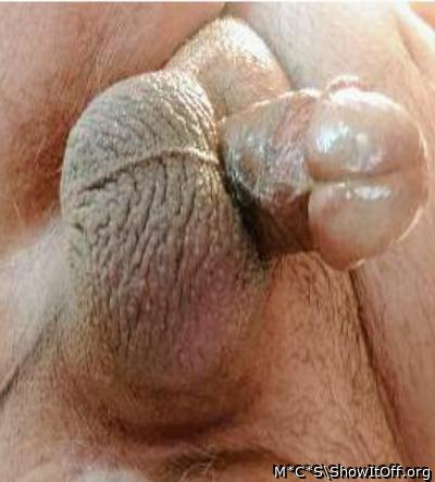 Photo of a short leg from M*C*S
