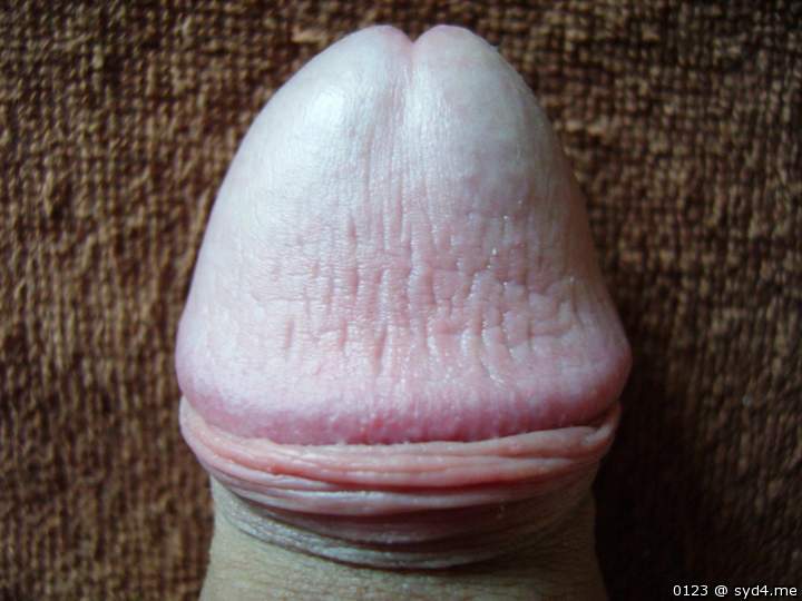 Beautiful! Circumcise it!