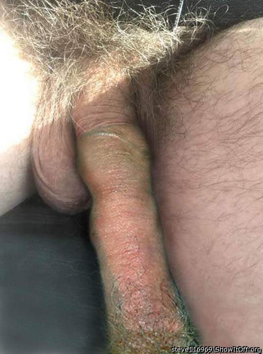 Good to have friends with foreskin
