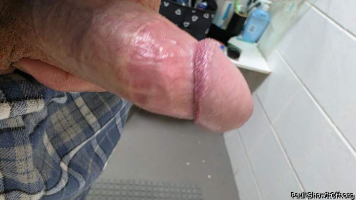Photo of a penile from Paul