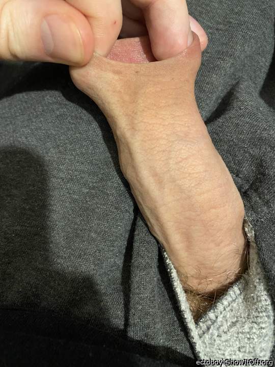 Stretching my foreskin