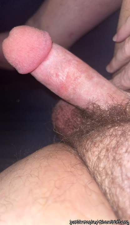 Photo of a middle leg from justliketoplay