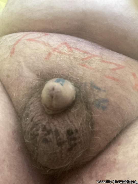 Testicles Photo from weewilly