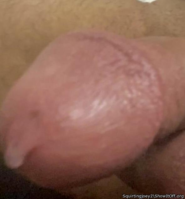 Photo of a bald-headed mouse from Squirtingjoey2