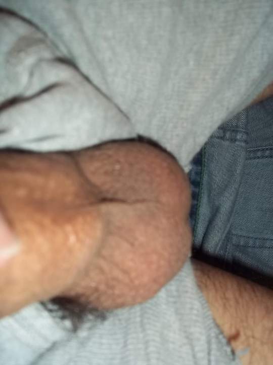 Testicles Photo from sdalex