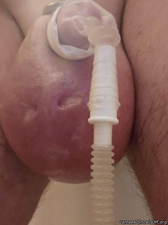 after4 hours with urinal condom