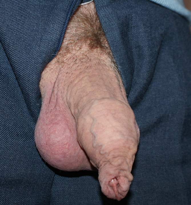 great Foreskin!!   