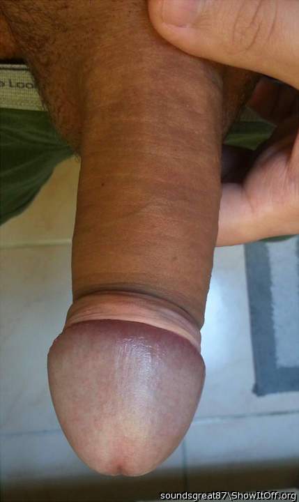 Steel glans ring holds my foreskin back