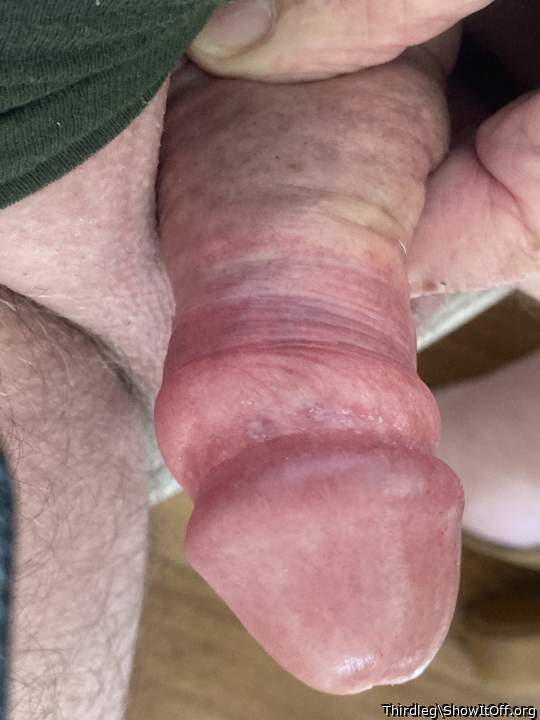 Photo of a middle leg from Thirdleg
