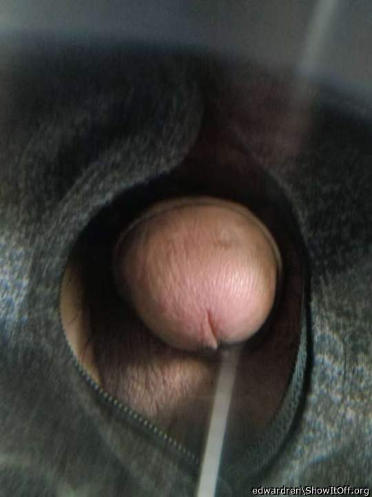 Photo of a prick from edwardren
