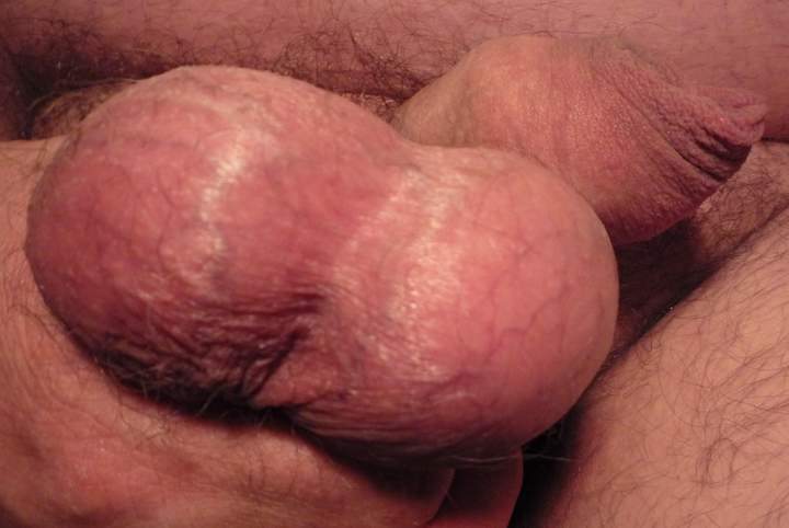 Testicles Photo from markcl