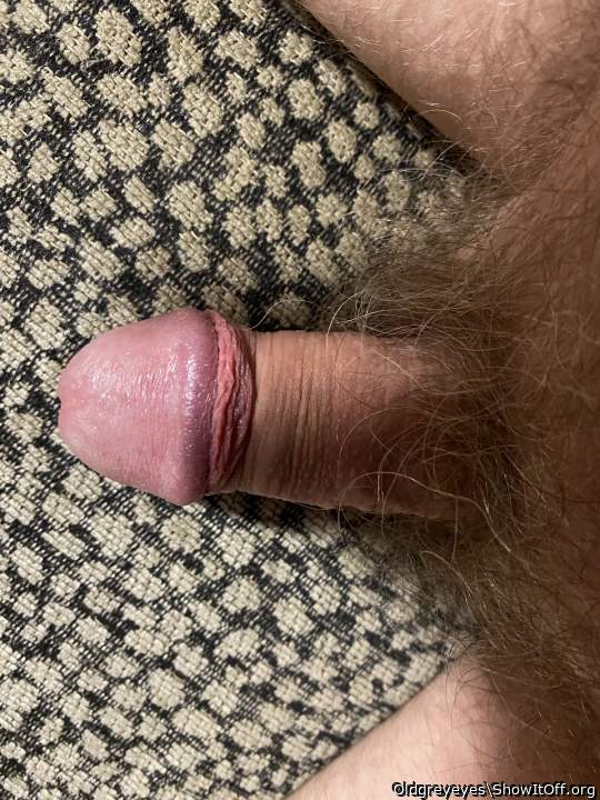 Photo of a penile from Oldgreyeyes