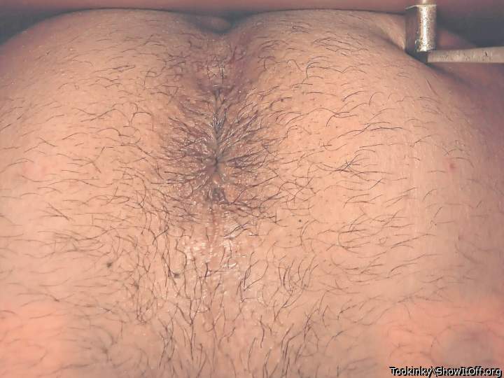 My asshole close up