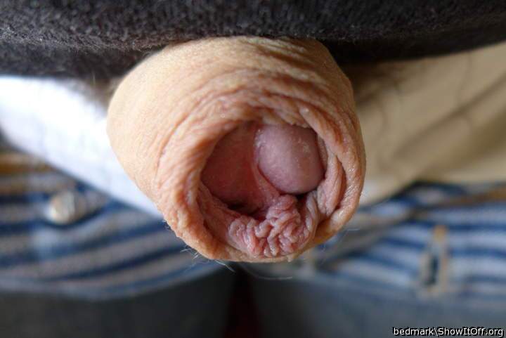 inside foreskin
