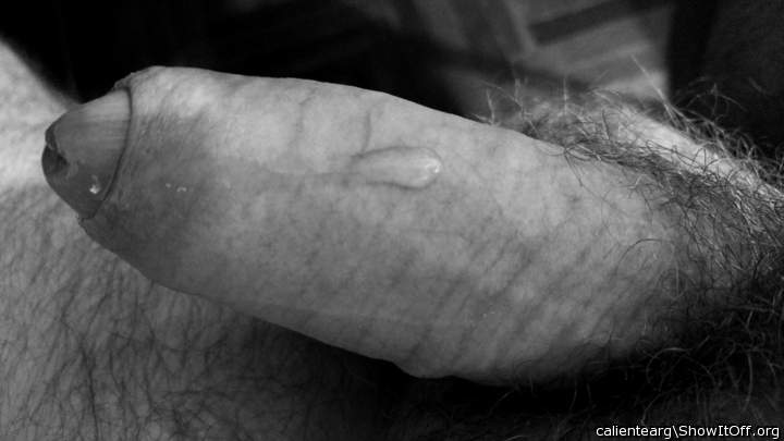 Photo of a penile from calientearg