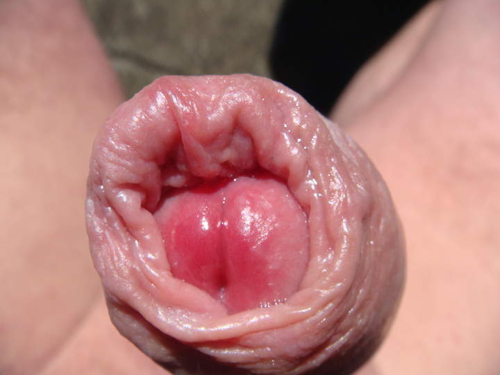 Photo of a short leg from sivad666