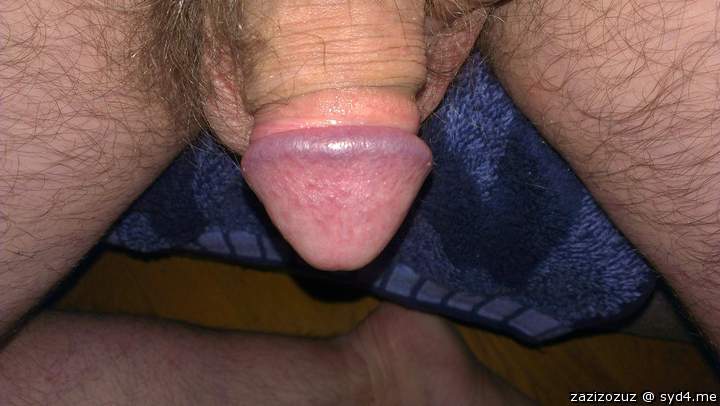my tiny glans ...