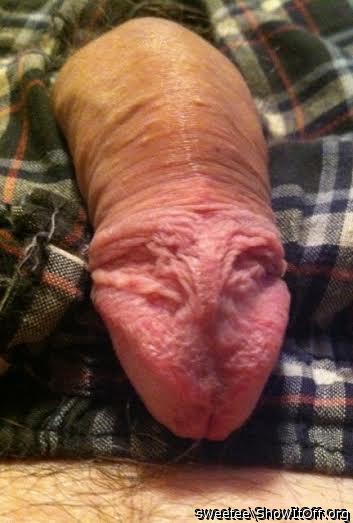 Great picture of that frenulum and retracted foreskin poking