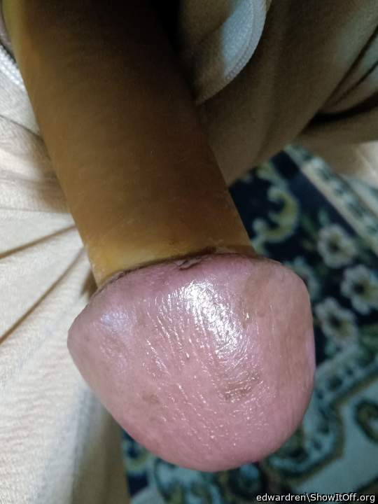 Photo of a love muscle from edwardren