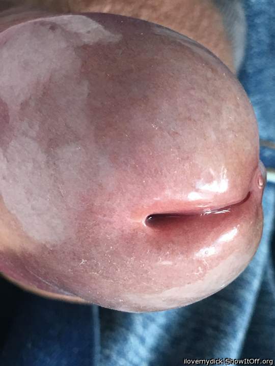 Photo of a purple headed monster from ilovemydick