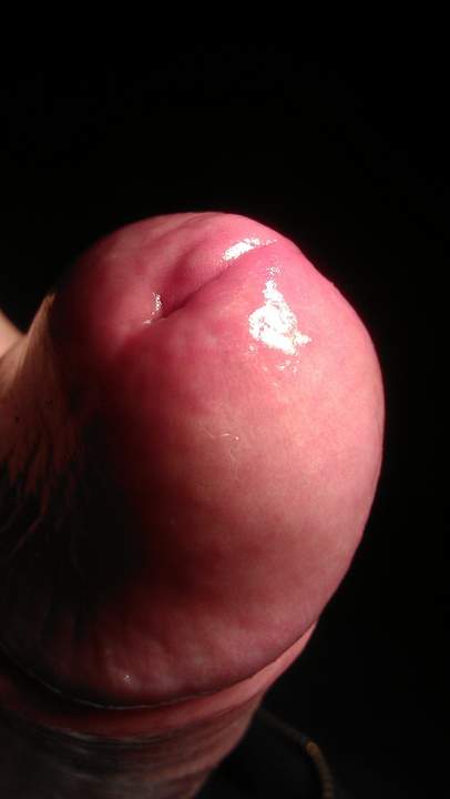 Photo of a third leg from Vanillacum