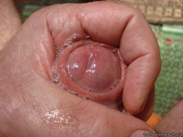 Photo of a penis from dischwa