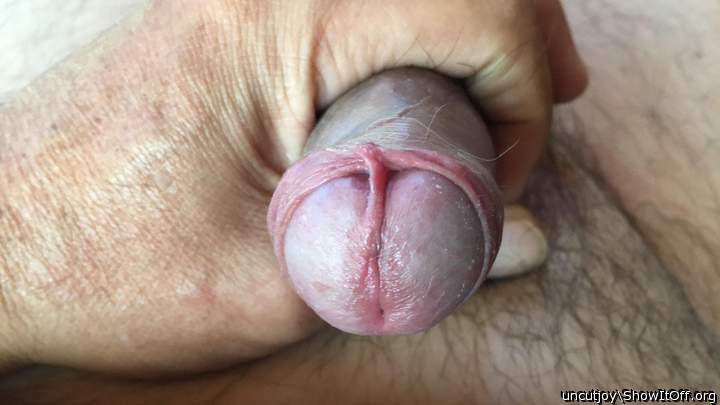 Frenulum stretch