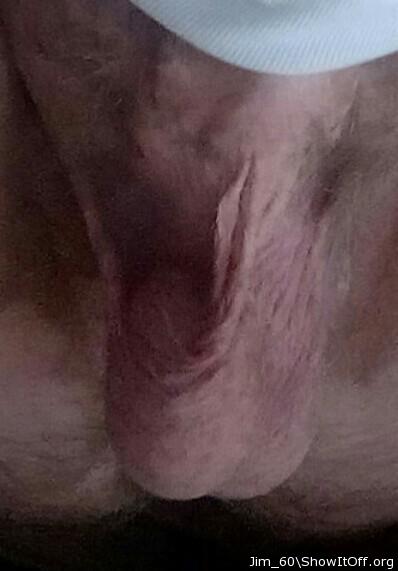 Testicles Photo from Jim_60