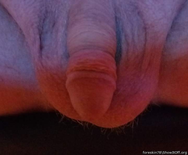 Photo of a equipment from foreskin78
