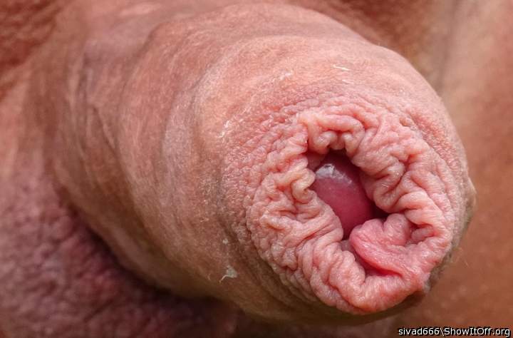 Photo of a prick from sivad666
