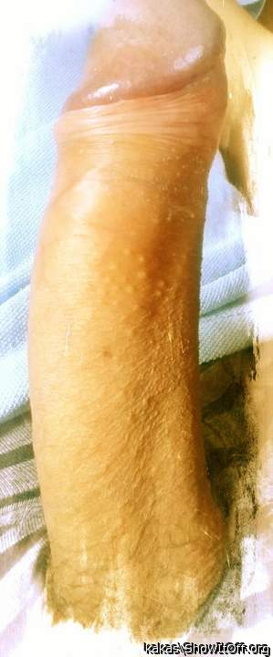 Photo of a penile from kakas