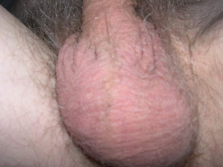 Testicles Photo from jollyroger