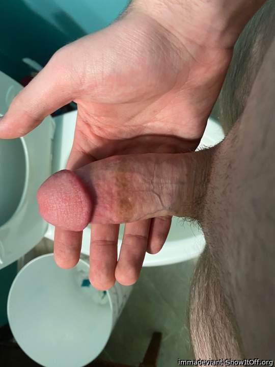 Photo of a penis from immadeviant