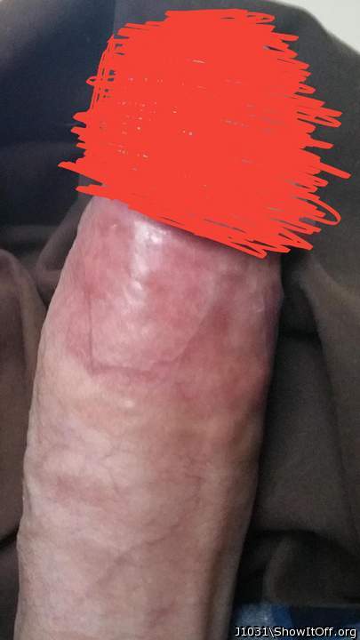 Photo of a phallus from J1031