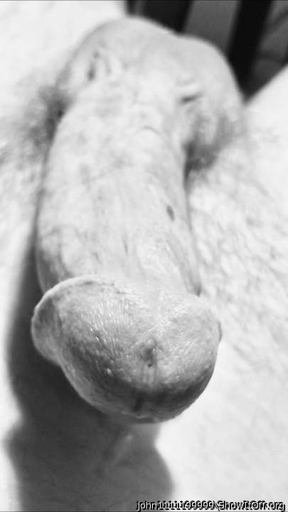 Photo of a penile from John1111199999