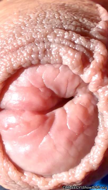 Foreskin Shot 1